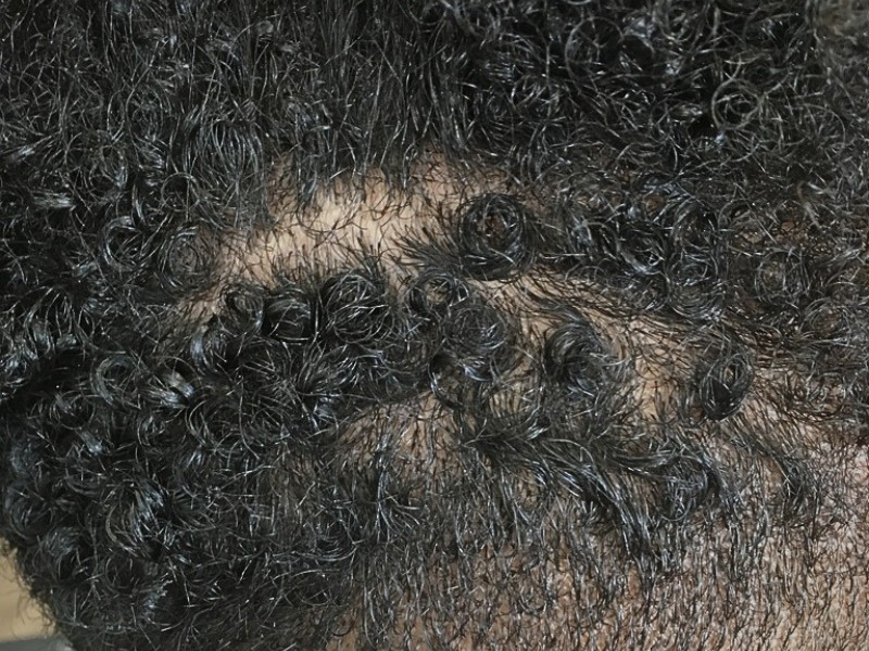 Satin scalp therapy treatment
